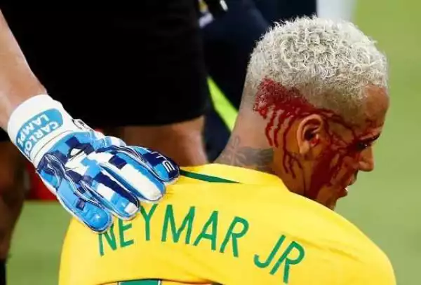 Neymar bloodied and battered as he